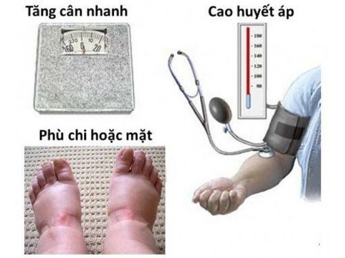 
Dấu hiệu tiền sản giật ở phụ nữ mang thai
