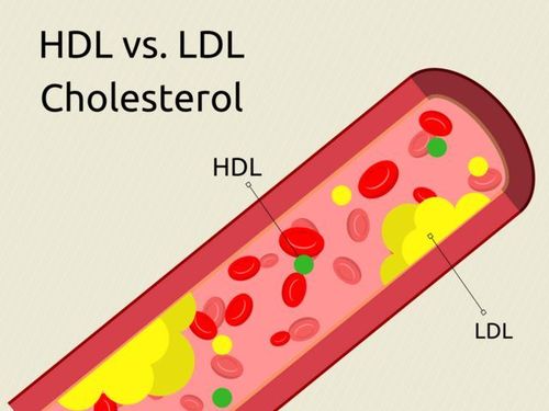 
Lipid máu HDL-C - Lipoprotein và LDL–C - Lipoprotein
