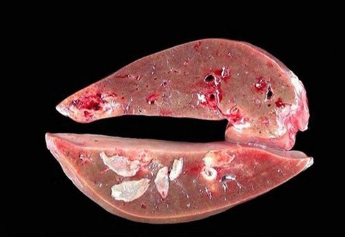 How to prevent liver fluke disease in humans?