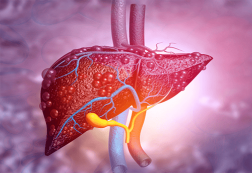 What should be noted in the care of patients with decompensated cirrhosis?