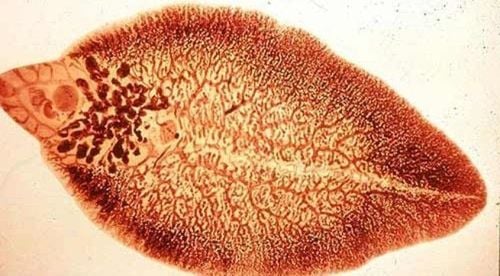 Test methods to diagnose small liver flukes