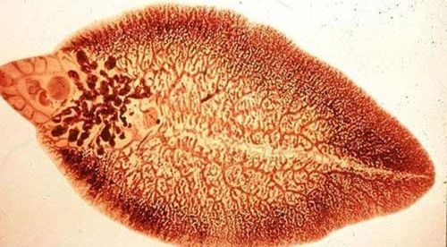 Small liver fluke disease: causes, treatment