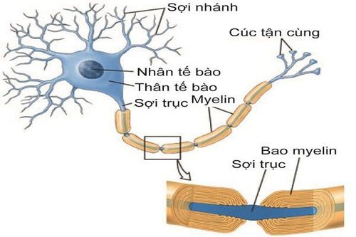 Bệnh viêm đa dây thần kinh huỷ myelin mạn tính (CIDP)