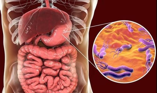 
Vitamin C hỗ trợ đào thải vi khuẩn Helicobacter Pylori ra khỏi cơ thể
