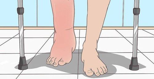Causes of body edema