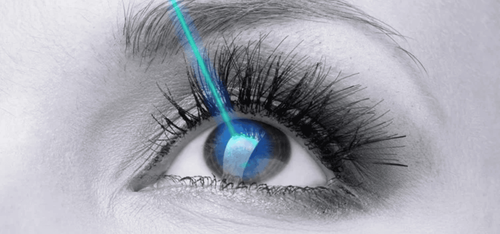 Is LASIK surgery safe for myopia?