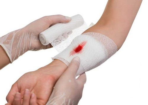Cách sơ cứu khi bị vết thương gây chảy máu bên ngoài