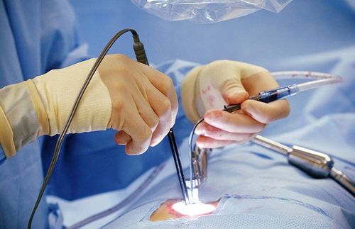 Anesthesia for analgesia in cardiovascular surgery
