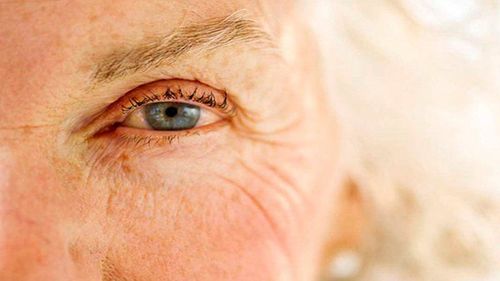 How is age-related macular degeneration diagnosed?