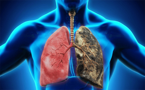 Lung cancer risks: Rumors and facts