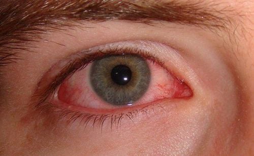 Mechanism of sympathetic inflammatory eye disease