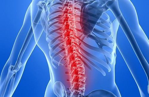 Diagnosis of spinal tuberculosis by any medical technique?