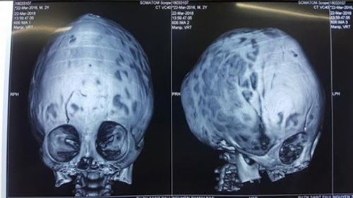 X-ray of the skull and face: What you need to know