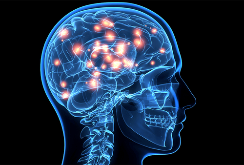 Measuring cerebral blood flow: What you need to know