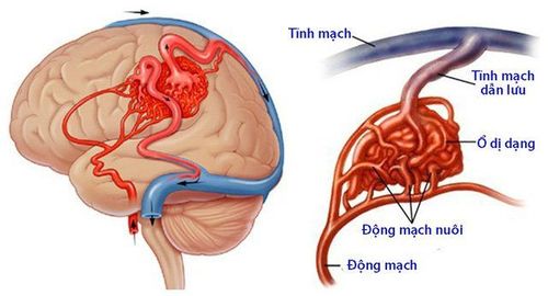 
Một nhóm các động mạch được nối trực tiếp với một nhóm tĩnh mạch
