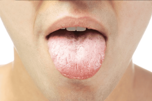 What do you know about your tongue?