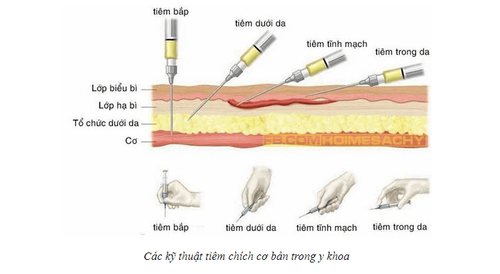 
Các kĩ thuật tiêm cơ bản trong y khoa
