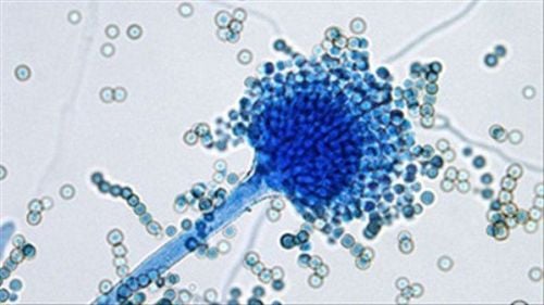 
Nấm Aspergillus là một trong các loại nấm gây tình trạng viêm kết mạc hiện nay
