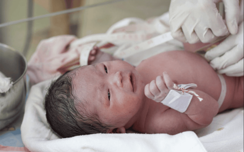 Early essential neonatal care after cesarean section