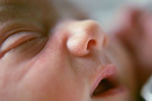 Treatment of conjunctivitis in infants