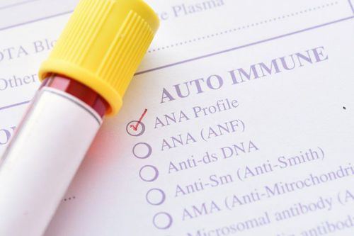 ANA test by immunofluorescence technique