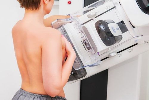 5 things to know about mammography