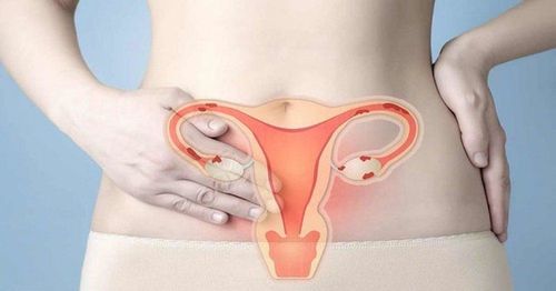 Benign disease in the lining of the uterus requires treatment?