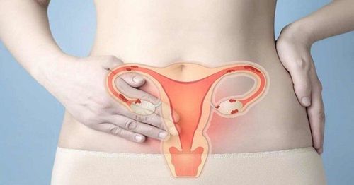 Niêm mạc tử cung dày 9mm có dễ mang thai không?