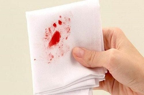 Why is vomiting blood after treatment for stomach bleeding?