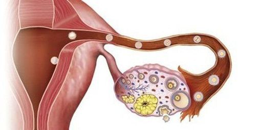 
Phụ nữ có chiều cao thấp hơn thì khả năng mắc ung thư buồng trứng cũng thấp hơn
