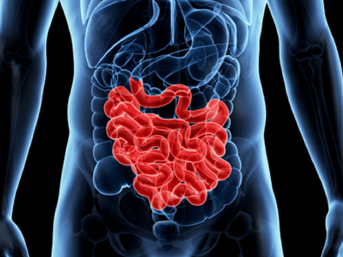 Perforation of small intestine by laparoscopic surgery