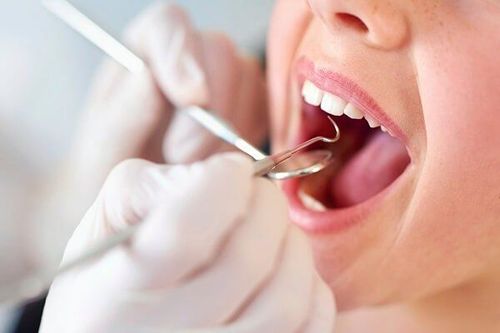 19 tuổi vẫn còn răng sữa hàm trên liệu có nên nhổ không?