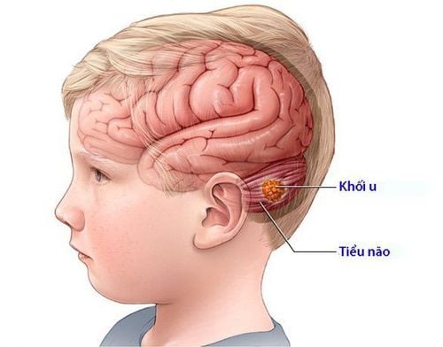 
Chụp MRI cho trẻ em thường diễn ra trong khoảng 45 phút
