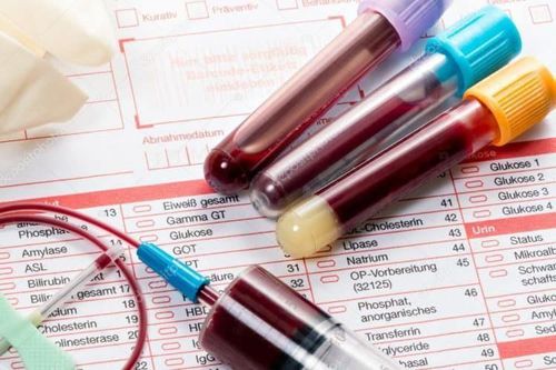 Thiếu máu có kết quả xét nghiệm như thế nào?