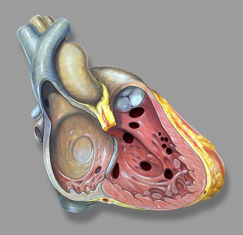 Can a 1mm ventricular septal defect close on its own?