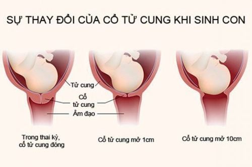 Stomach stiffness, cervix dilated 1cm should be hospitalized?