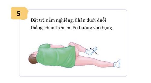 Khi nào dùng thuốc đạn (thuốc đặt trực tràng) hạ sốt cho trẻ?