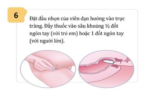 Khi nào dùng thuốc đạn (thuốc đặt trực tràng) hạ sốt cho trẻ?