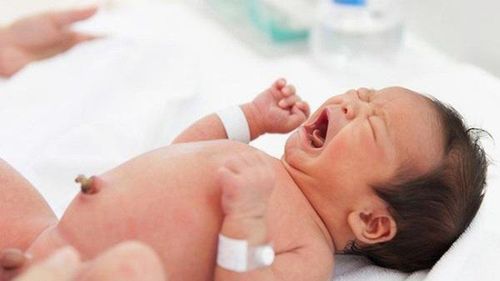 Trẻ sơ sinh 1 tháng tuổi có mổ thoát vị bẹn được không?