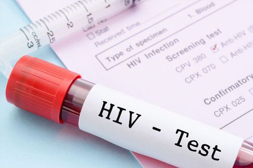 Đo tải lượng virus có đánh giá kết quả nhiễm HIV không?