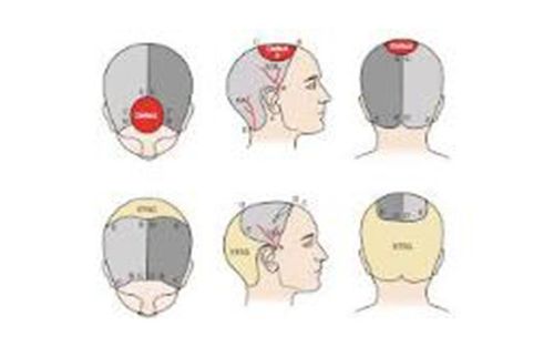 Surgical treatment of complex scalp wounds