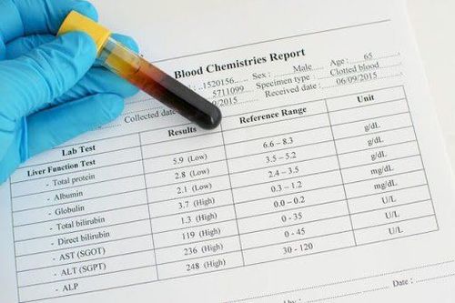 Chỉ số xét nghiệm HBV-DNA ở mức nào sẽ được chỉ định dùng thuốc?