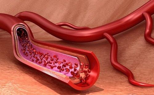 Distinguish between arteries, veins and capillaries