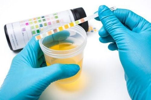 Dark yellow urine when gestational diabetes is worrisome?