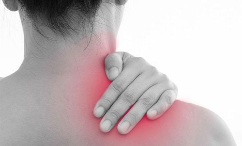 Hội chứng cổ vai cánh tay - Tình trạng căng cơ và cách để giảm căng cơ vùng cổ (Cervical scapulohumeral syndrome)
