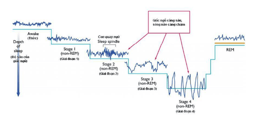 
Sóng điện não trong các giai đoạn của giấc ngủ
