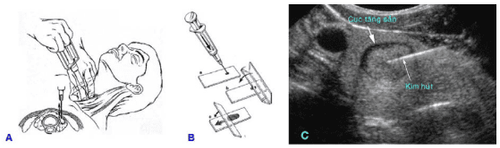 How long does it take to get results by fine needle aspiration thyroid cytology (FNA)?