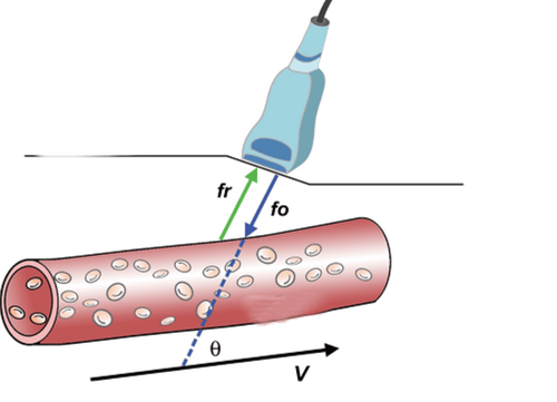 Is vascular ultrasound painful?