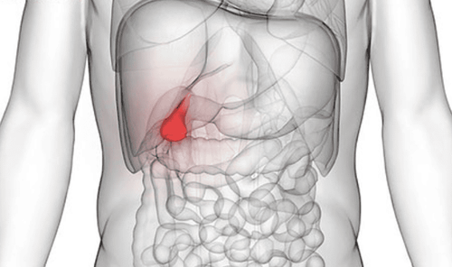 Risk factors for gallbladder cancer