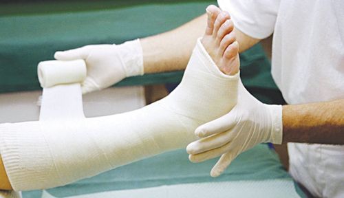 Methods of treatment of fractures of the fibula heal quickly